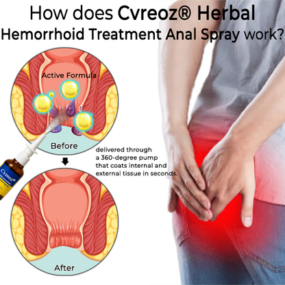 Coredew® Herbal Hemorrhoid Treatment Anal Spray Pro